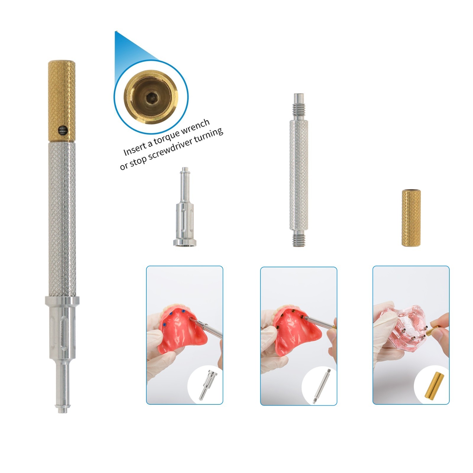 US Dental Fit Zest Anchors Locator Retention Caps Range & Core Tool Overdenture