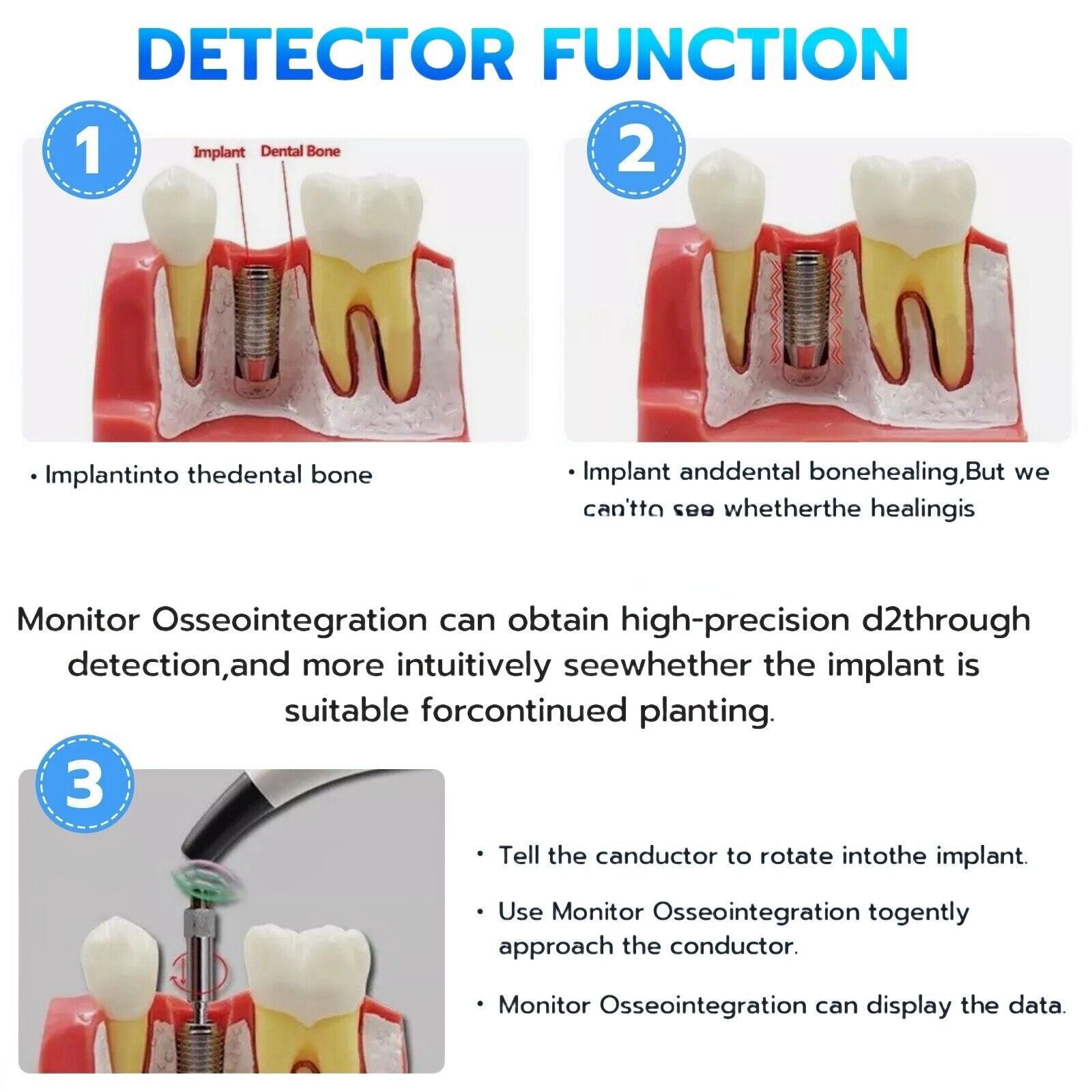 Dental Monitor Osseointegration RFA Inplant Stability Test Unit ISQ USA