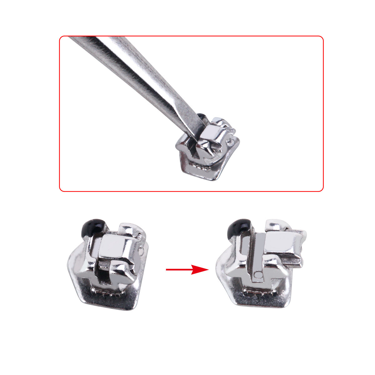 AZDENT Dental Orthodontic Self-Ligating Bracket Braces Roth/MBT .022 Hooks 3 4 5