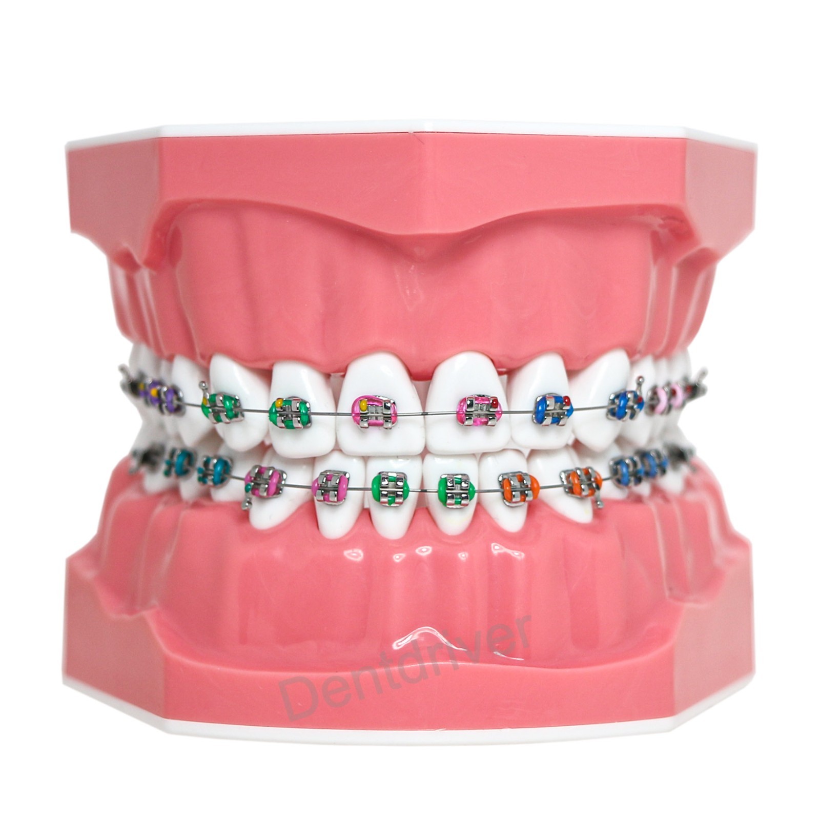 US Orthodontic Typodont 1:1 Teeth Model M7010-2 Fixed Brackets Braces Teaching
