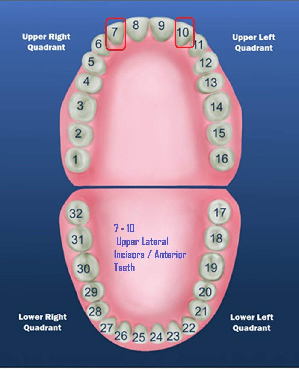DENTAL POLYCARBONATE TEMPORARY CROWNS #25 (ULL) UPPER LEFT LATERAL 5/PACK