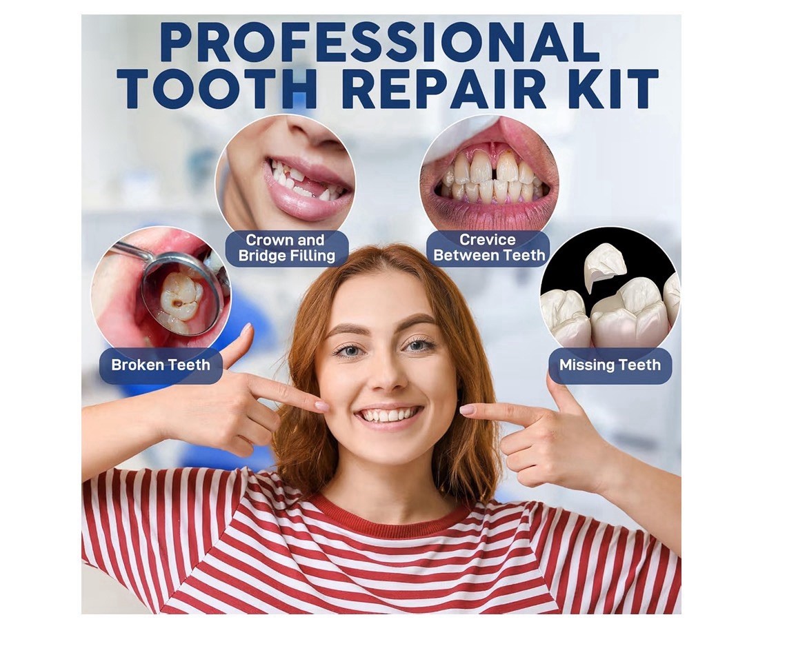 CLYVO Dental Repair Kit Zinc Oxide Eugenol Temporary Tooth Filling Crowns