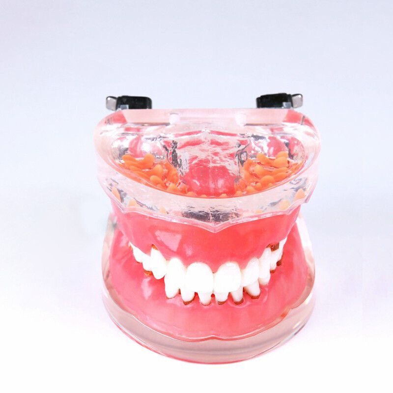 Dental Adult Pathological Periodontal Disease 4017# Dental Typodont Teeth Model