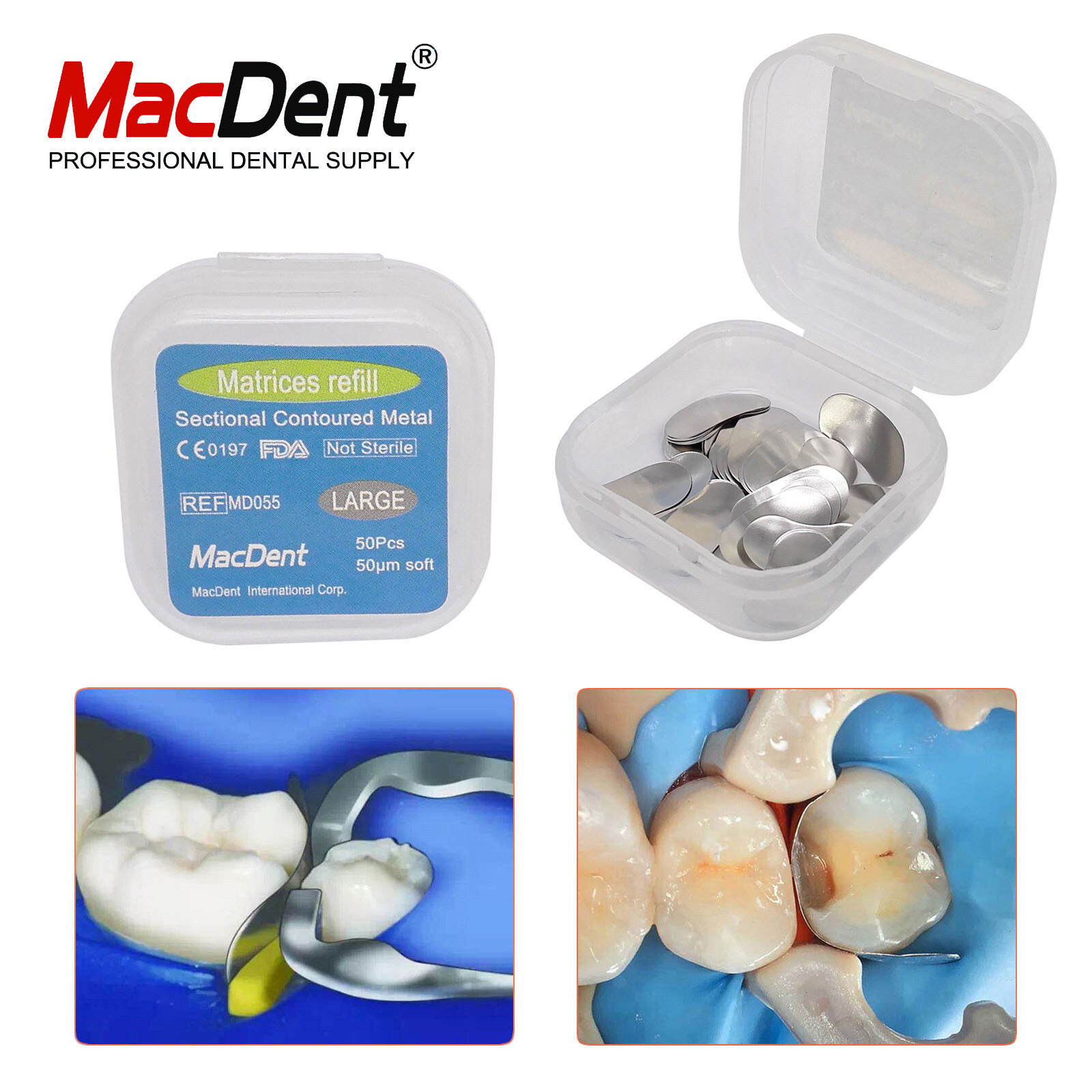 50Pcs/Box Dental Matrices Bands Metal Matrix Band Sectional Contoured Refill Box