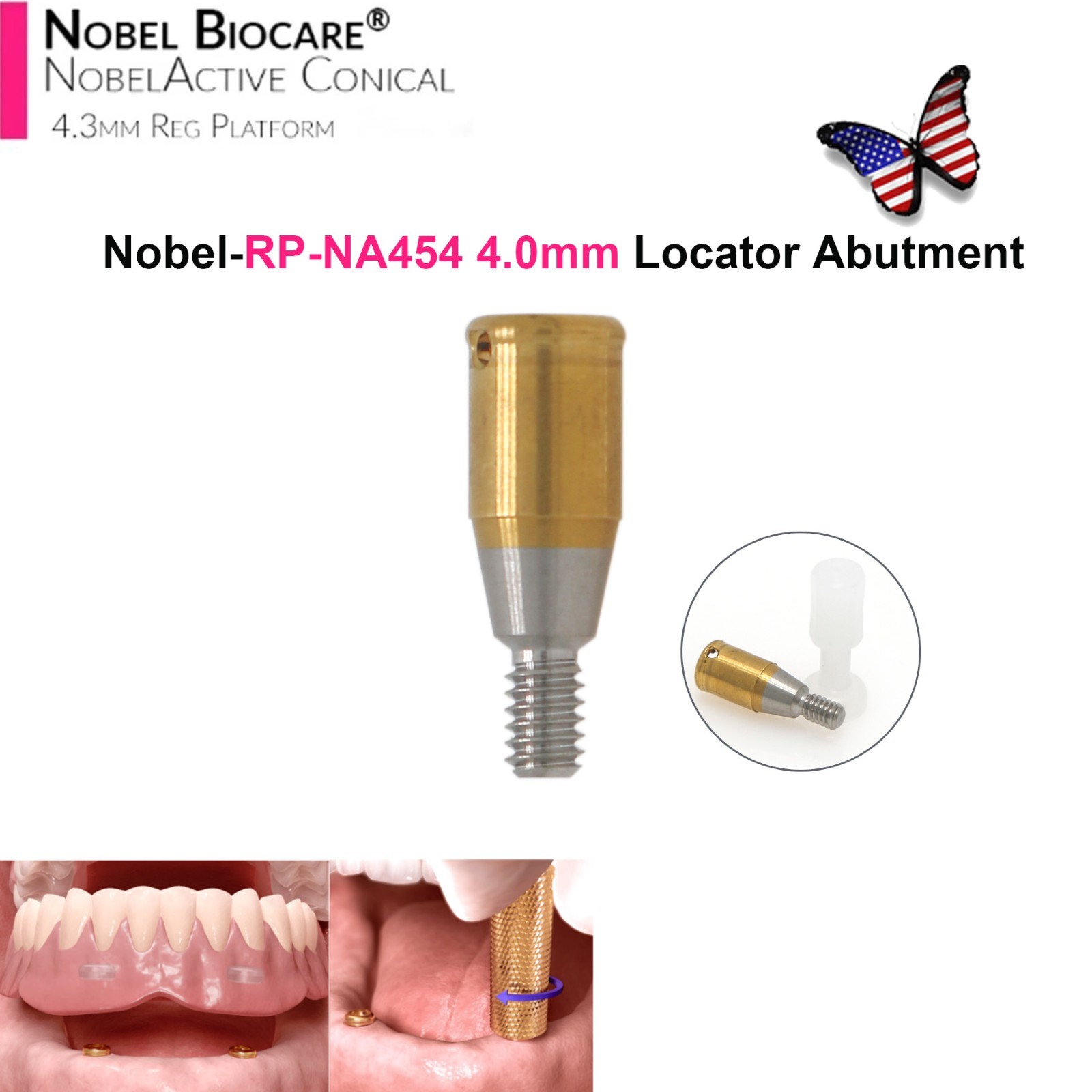 Dental Locator Abutment NP RP Compatible with Nobel NBL Active Implant AH 1–5mm