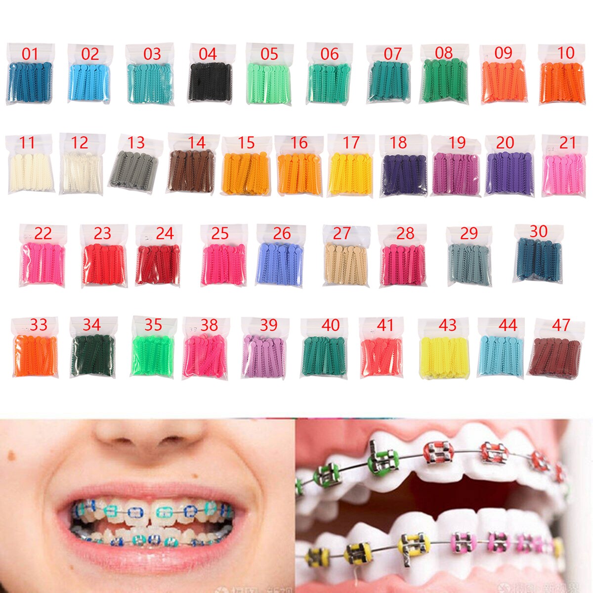 1040Pcs/Pack Dental Orthodontic Ligature Ties Elastic Rubber Bands Braces SKYSEA