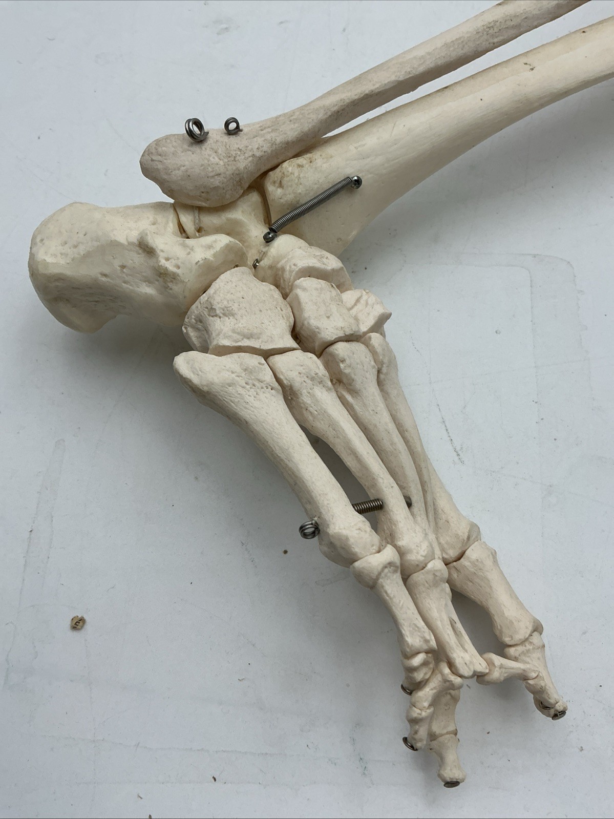 3B Scientific Leg Skeleton with Pelvic Bone Physiological Phil A15/3 Replacement