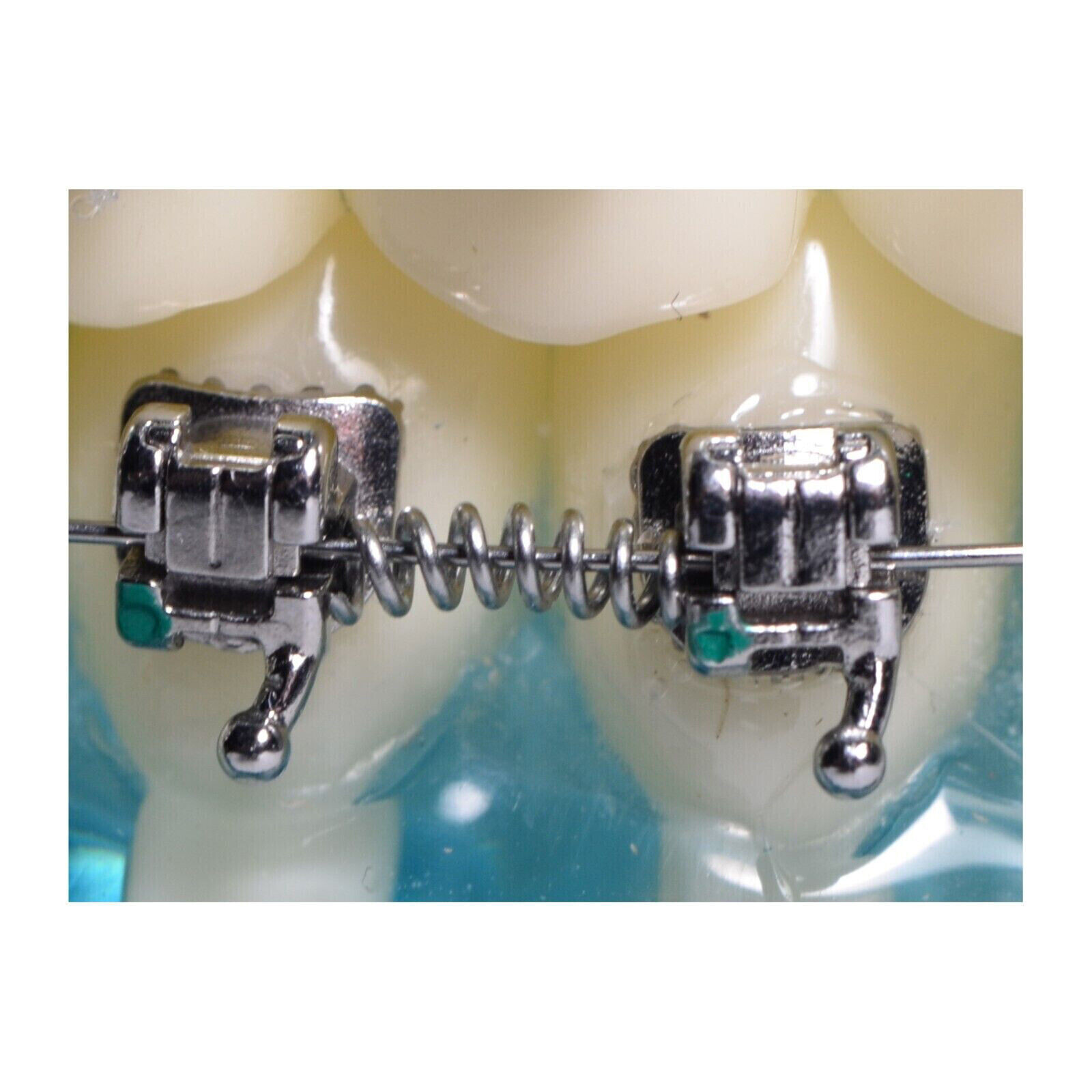 Dental Orthodontic 180mm Niti Open Coil Spring Arch Wires Alloy Dia.08/10/12/14