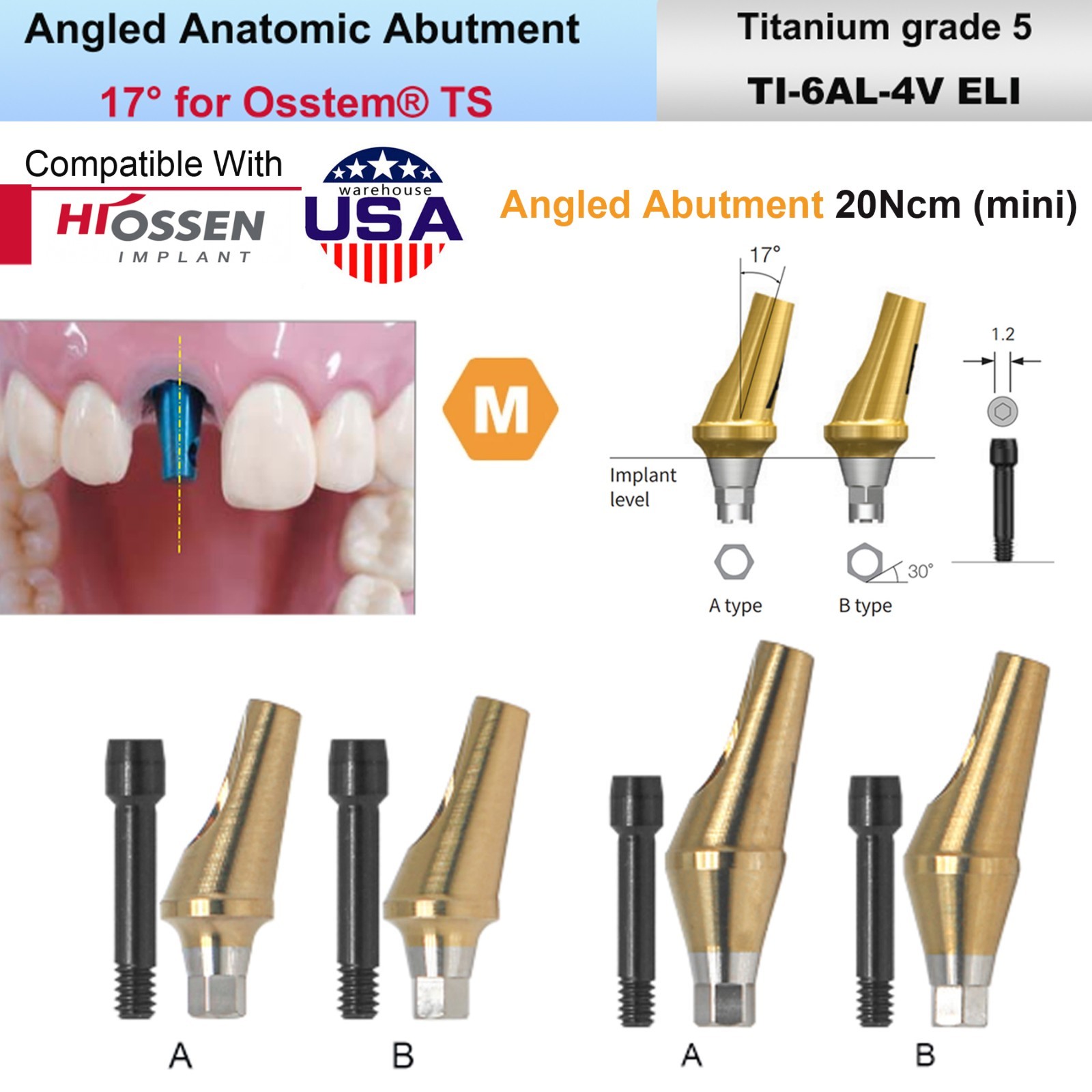 US 5Pcs 17° Angled Anatomic Abutment Hiossen Osstem Mini Regular Hex Titanium