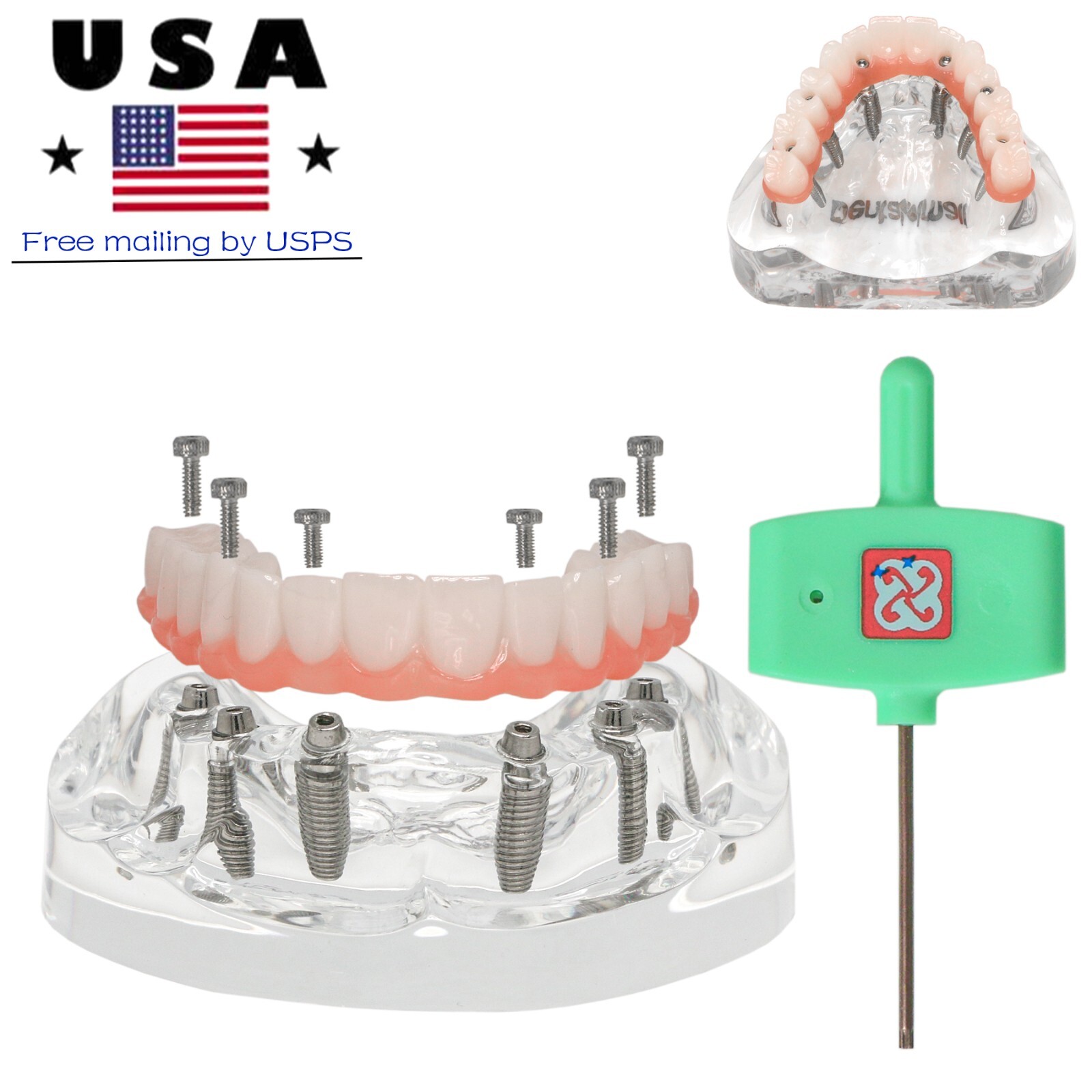 US Overdenture All-On-4/6 Implant /Ortho/Columbia 860/Kilgore NISSIN Teeth Model