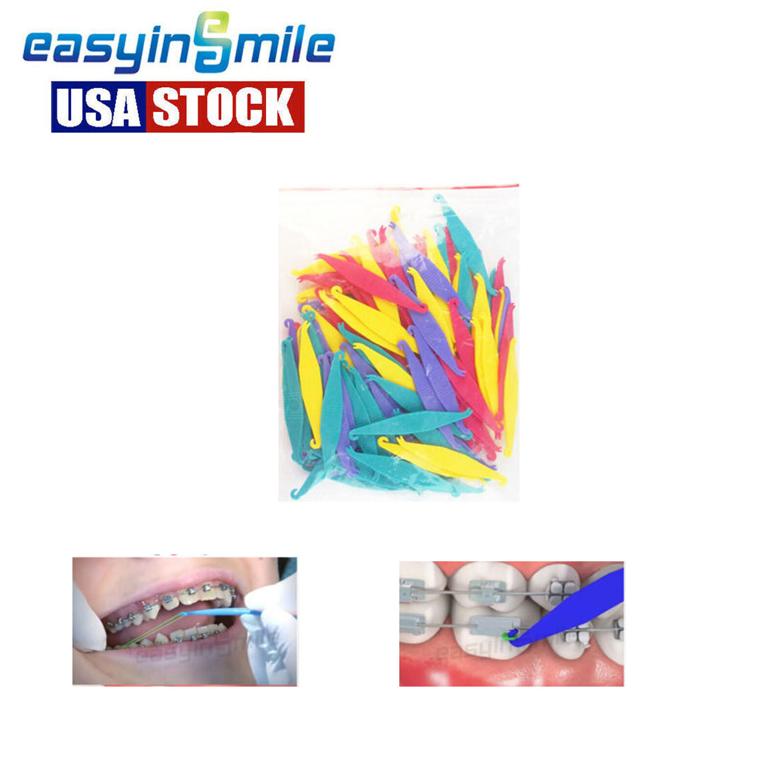 100Pcs Dental Orthodontic Rubber Bands Elastic Placer Plastic Brace Mixed Color
