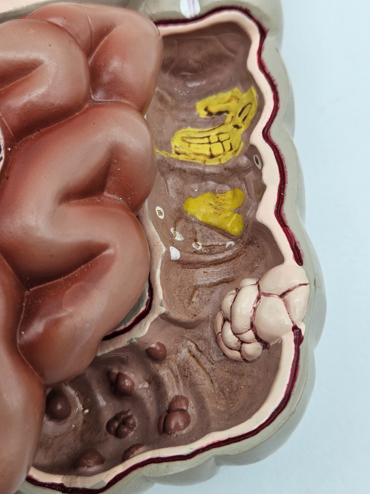 GI Tract Anatomy Model Handpainted Medical Display Gastro Intestinal Display