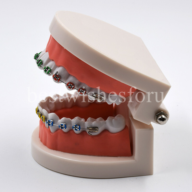 1*Dental Orthodontic Standard Teeth Tooth Model Metal Brackets & Ligature Ties