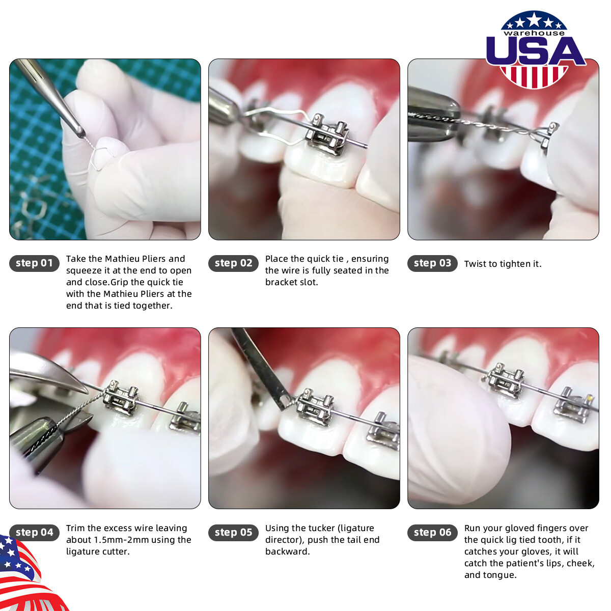 AZDENT Dental Ortho Wire Preformed Ligature Ties Long Short Twist 100pcs/Pack