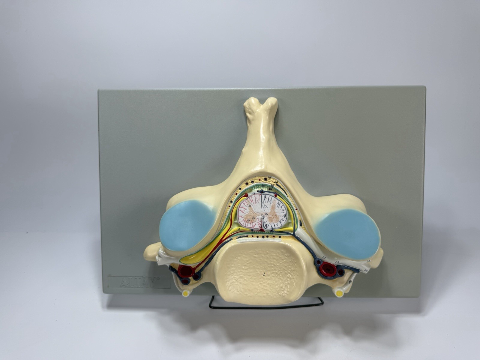 Vintage Fifth Cervical Vertebra Medical Model Heavy Plastic Numbered