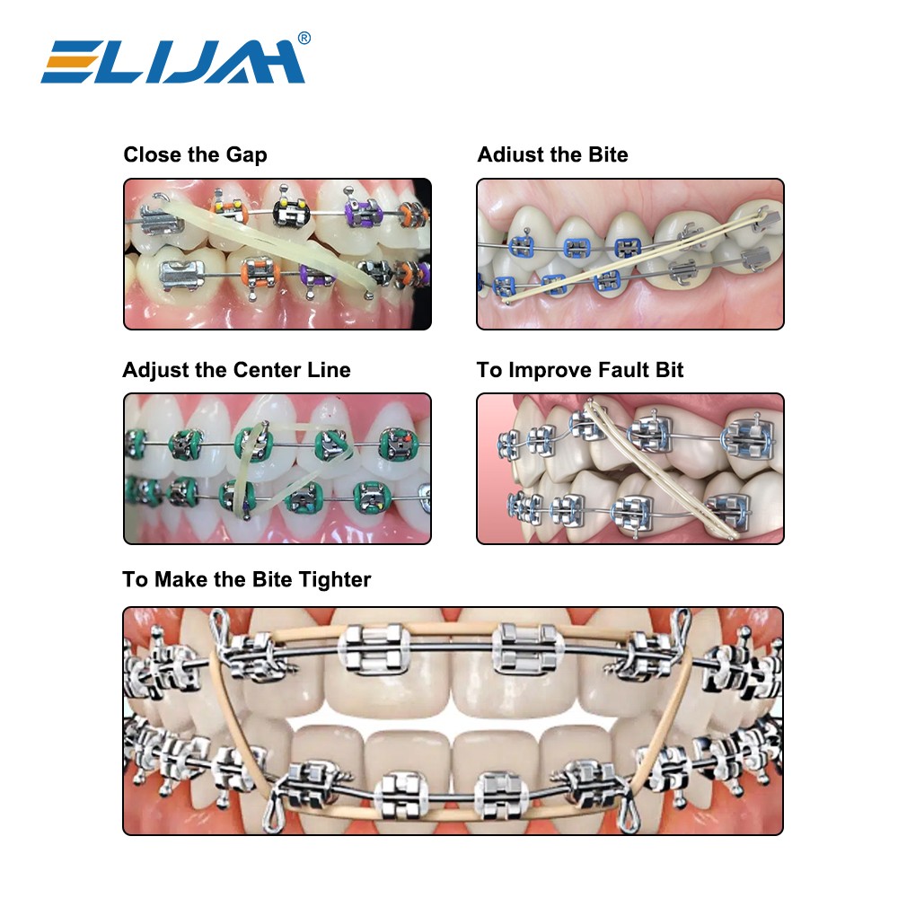 Dental Orthodontic Elastic Rubber Band Latex Braces 3.5/5.0/6.5 OZ Zoo Pack