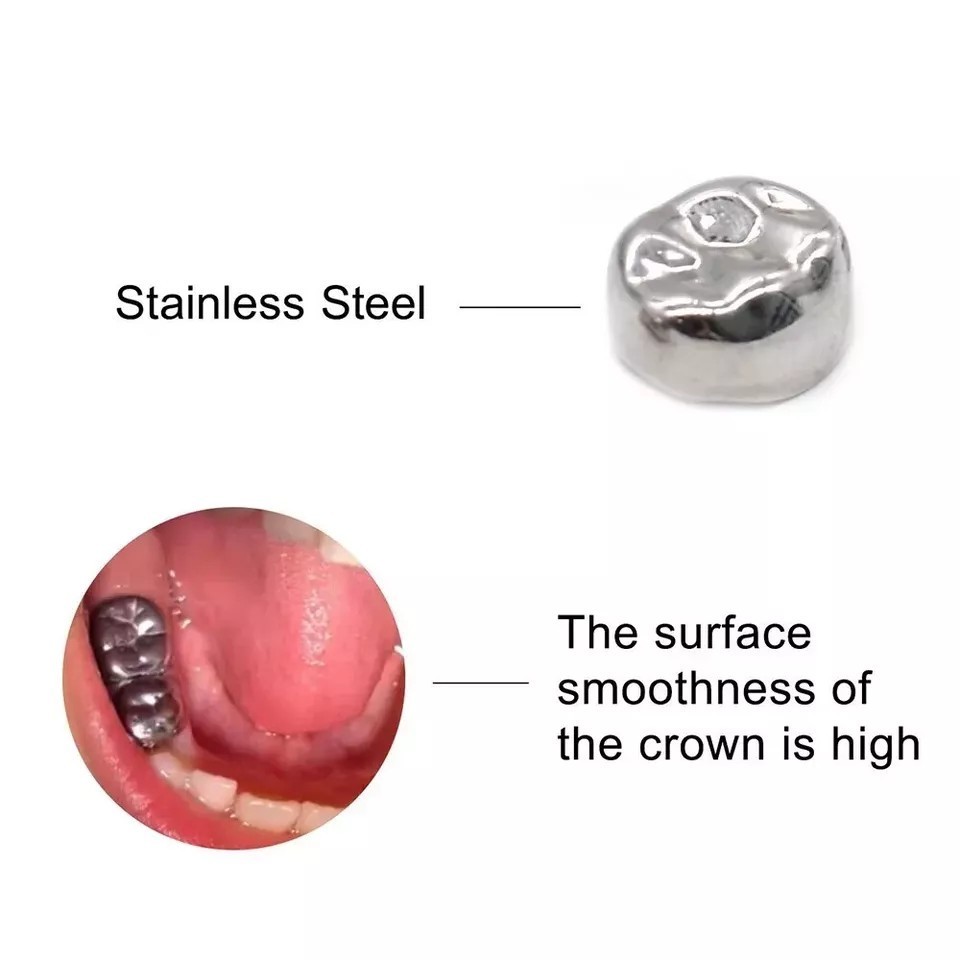 5 Pcs/Box Dental Stainless Steel Kids Primary Molar Crown Pediatric Metal Crowns