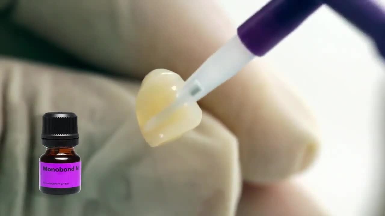 Ivoclar Monobond N Universal Primer 5g for all types of Restorative Materials