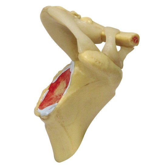 Shoulder Osteoarthritic 4-Stage GPI Anat Model Set LFA#1800 Make OfferSEE VIDEO
