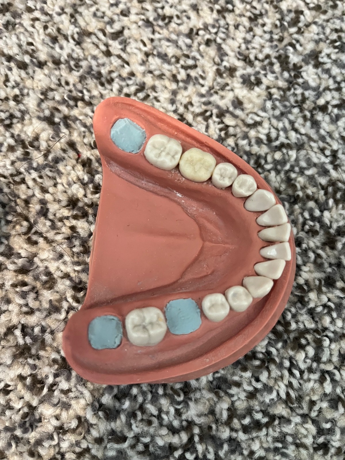 Mandibular dentition typodont dental student practice teeth