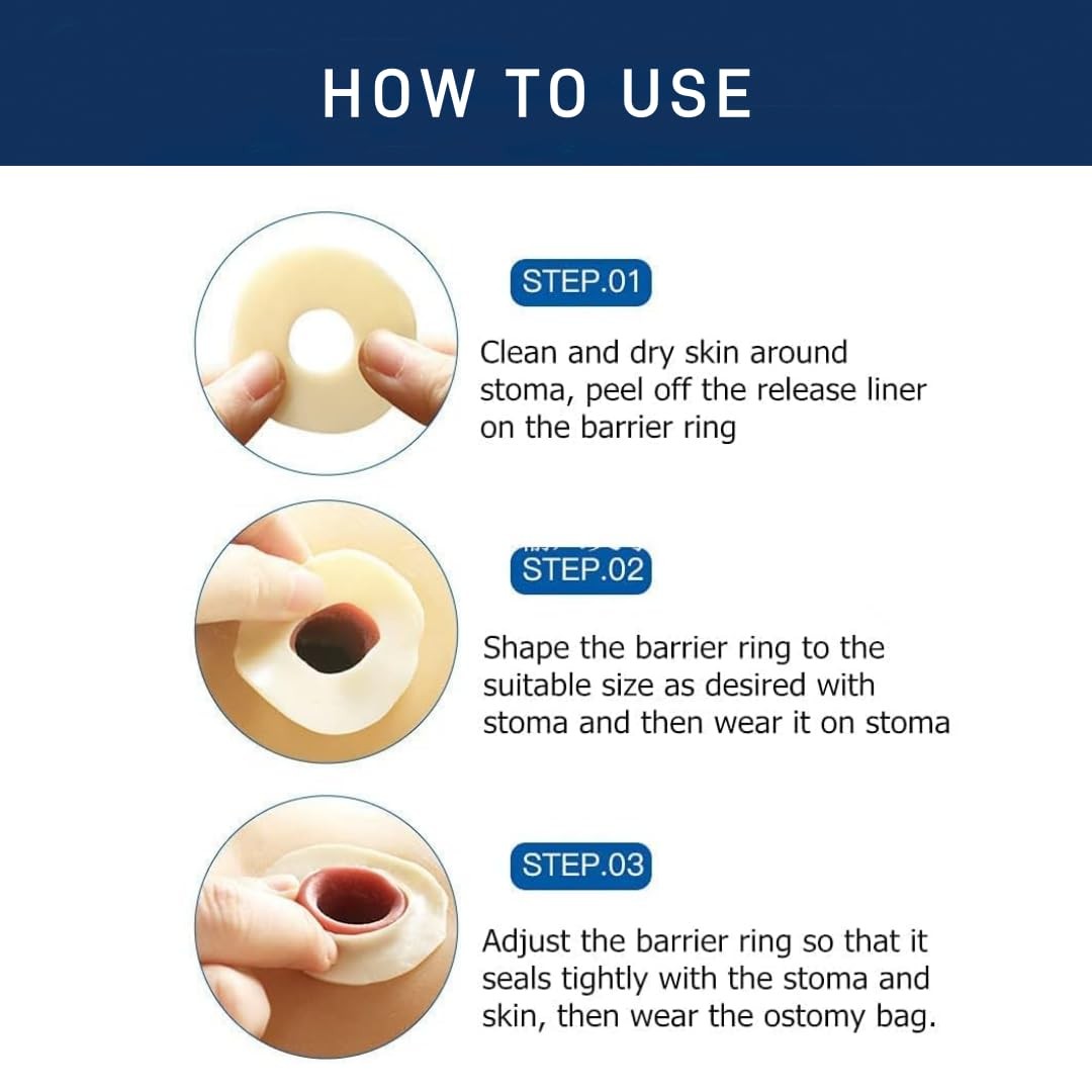 10 PCS Ostomy Barrier Rings, 2mm 10 Count (Pack of 1), 2mm,10pcs/Box