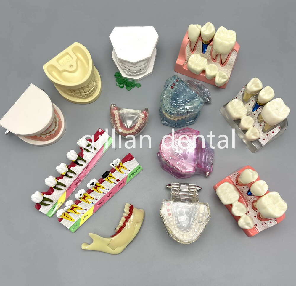 Dental Model Teeth Implant Restoration Bridge Teaching Study Medical Science