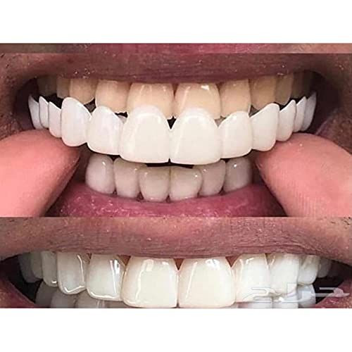 New Silicone Gel Smile Upper and Lower Cosmetic 1 Count (Pack of 1), Natural