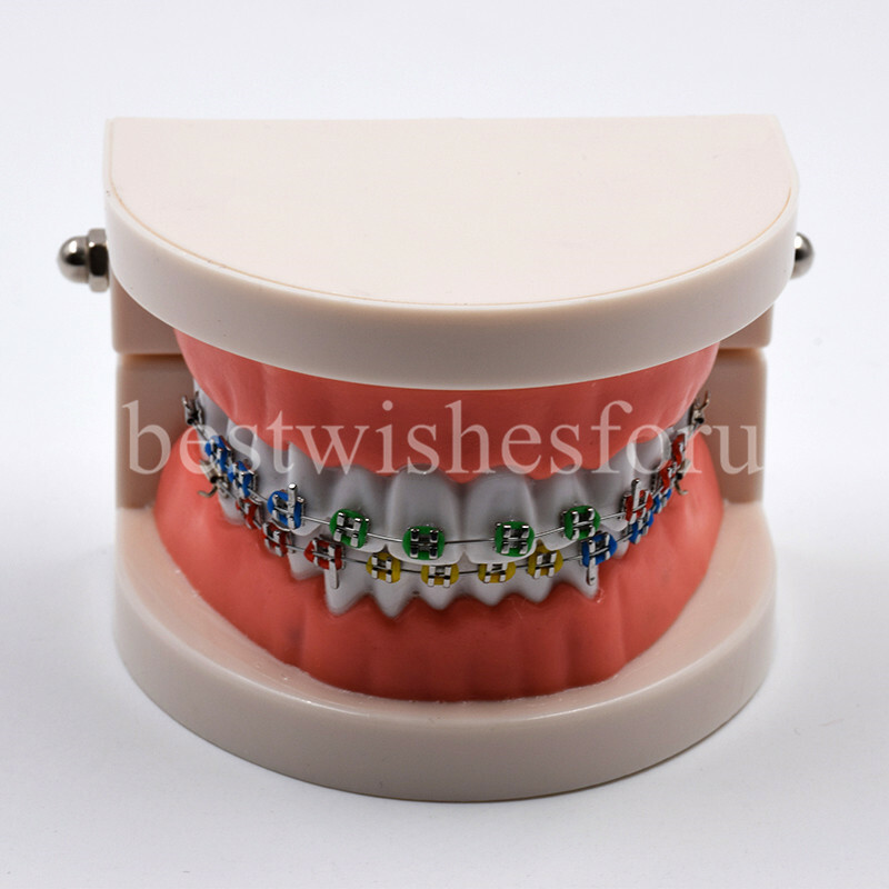1*Dental Orthodontic Standard Teeth Tooth Model Metal Brackets & Ligature Ties