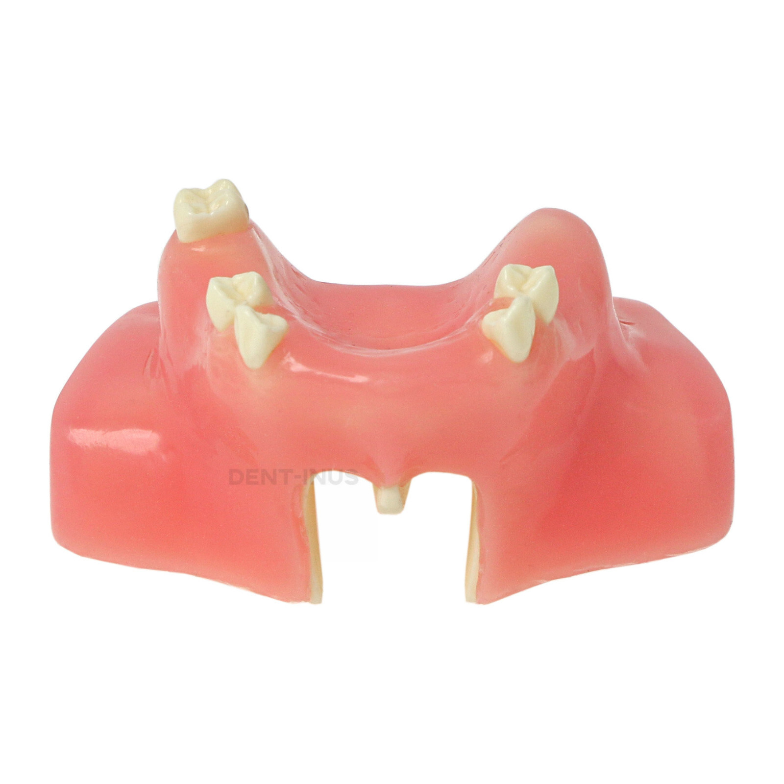 Dental Maxillary Teeth Model Sinus Lift Implant Practice Study Teach Demo Model