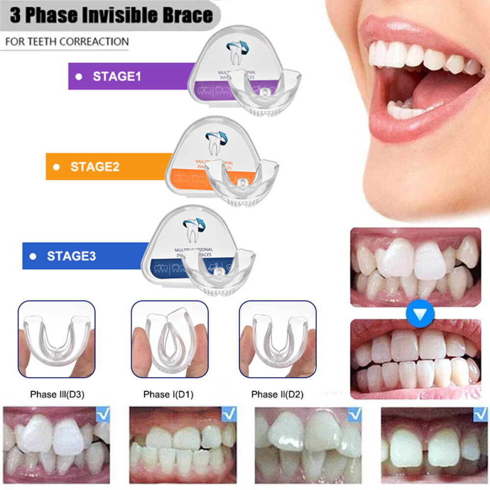 3-Stage Adult Teeth Aligners Orthodontic Braces Trainer for Dental Alignment Hot