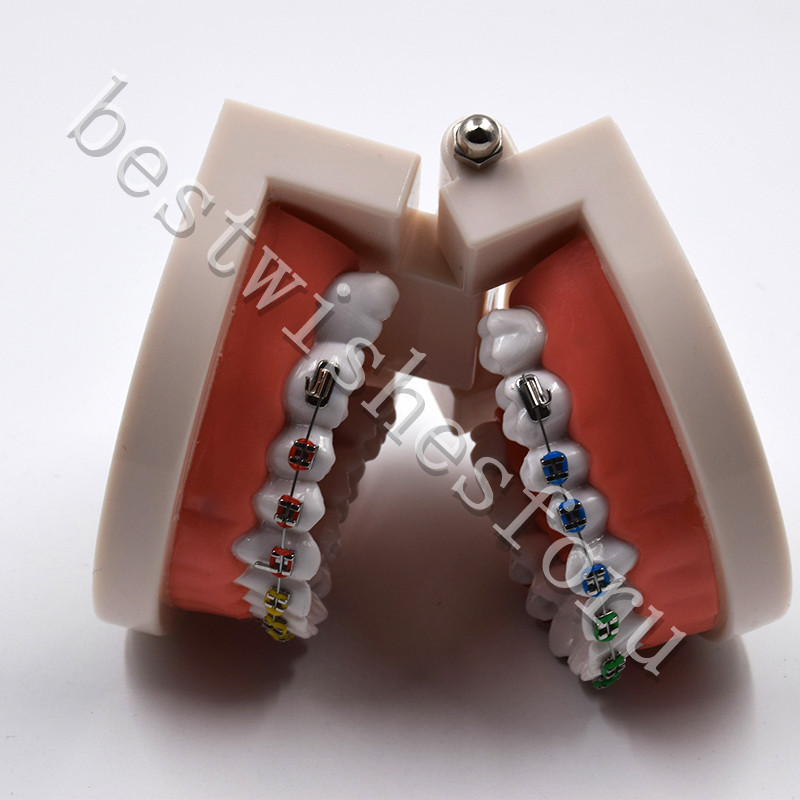 Dental Orthodontic Standard Teeth With Metal Brackets Ligature Ties Hoop Model