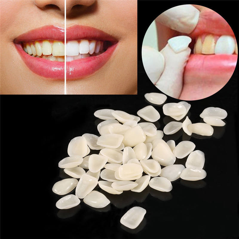 Dental Temporary Crown Veneers Tooth Repair Kit Replacement A1, A2 50Pieces/Pack