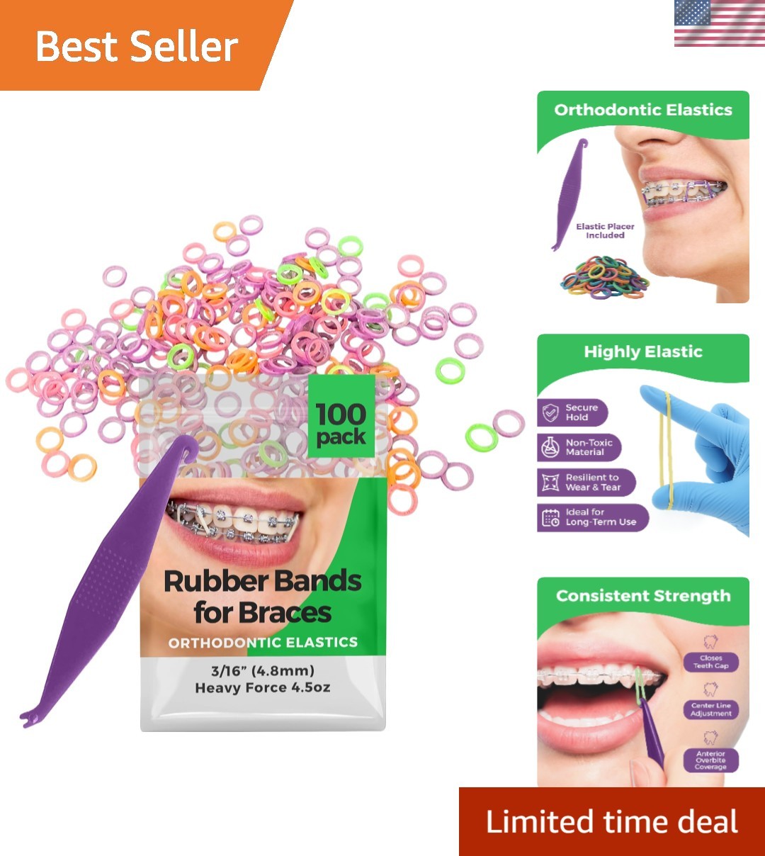 Comfortable 3/16 Neon Elastic Bands – Ideal for Braces, Hair & Crafts, 100 Pack