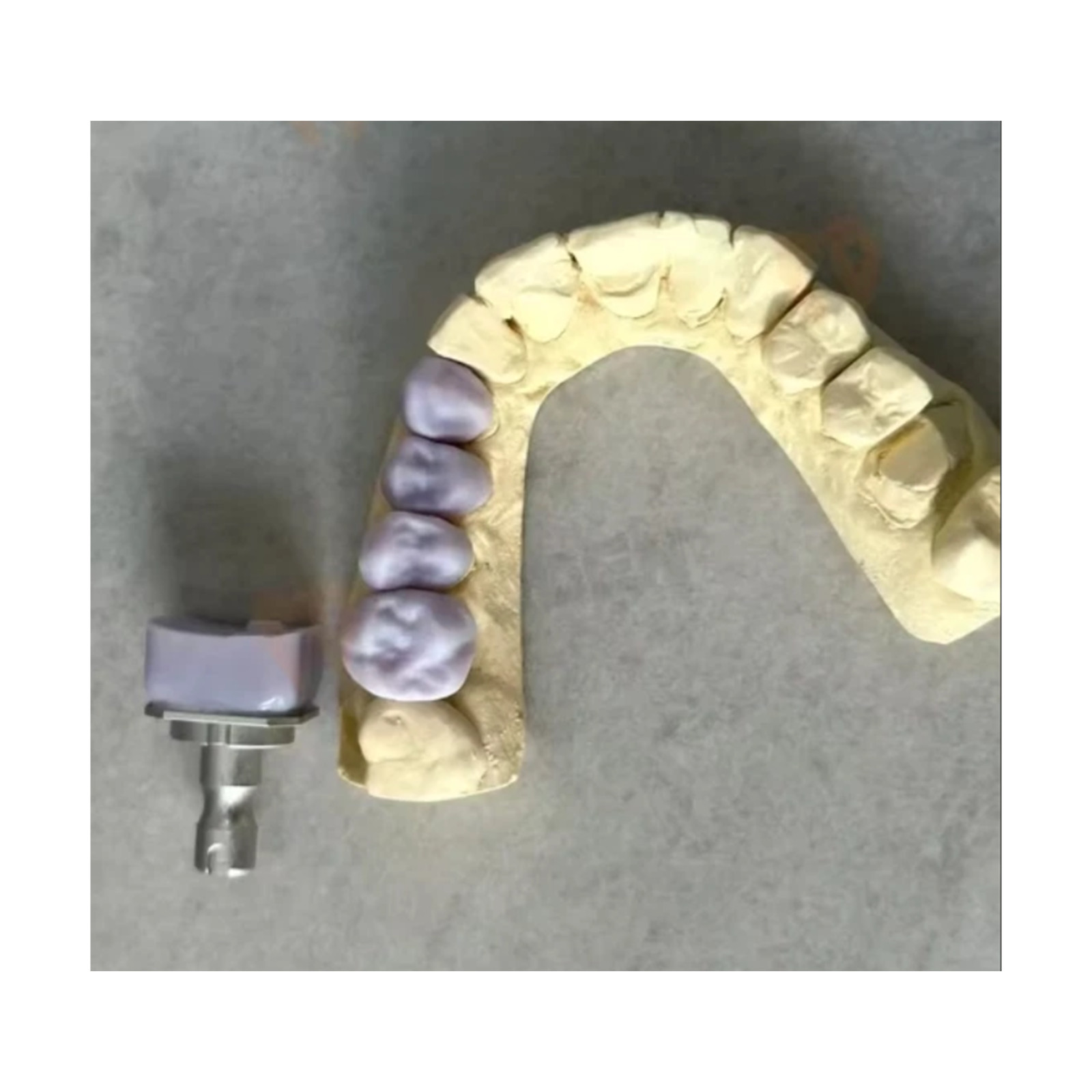 Dental Emax Glass Ceramic Blocks C14 CAD/CAM Lithium Disilicate CEREC Block 5PCS