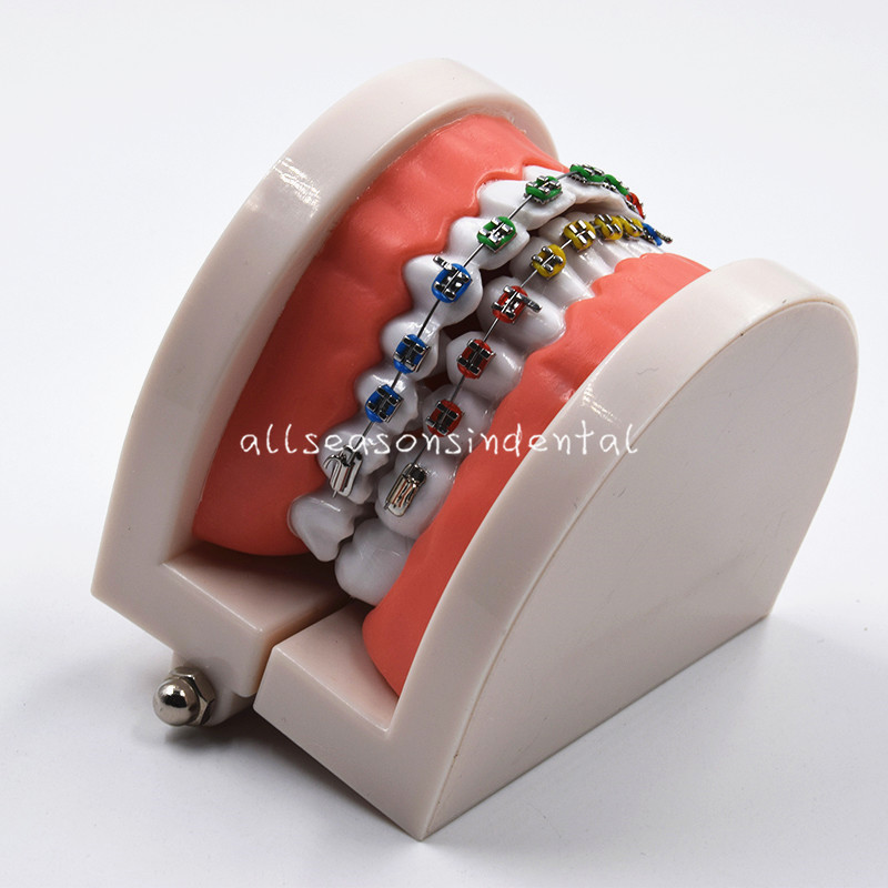 Dental Orthodontic Standard Teeth Model With Brackets Buccal Tube Ligature Ties