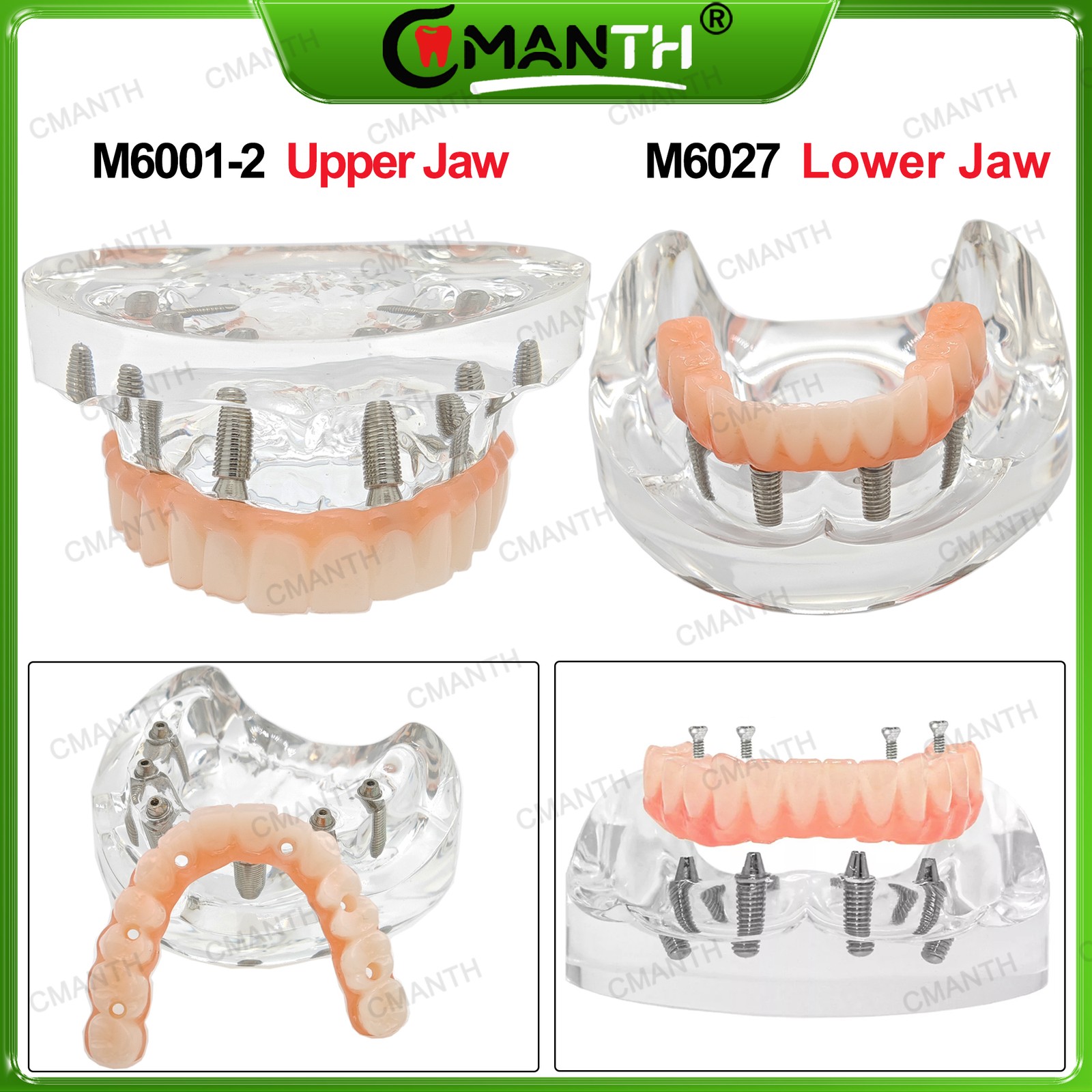 Multiple Types Dental Teeth Model Ortho Implant Practice Teaching Demo Model