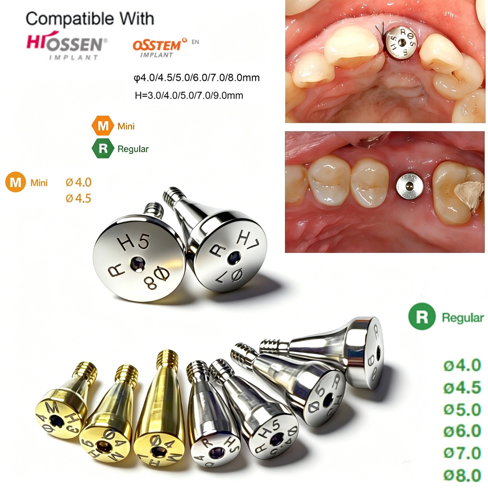 US Dental Healing Abutment Cover Screw Regular Platform Compatible Oss Hiossen
