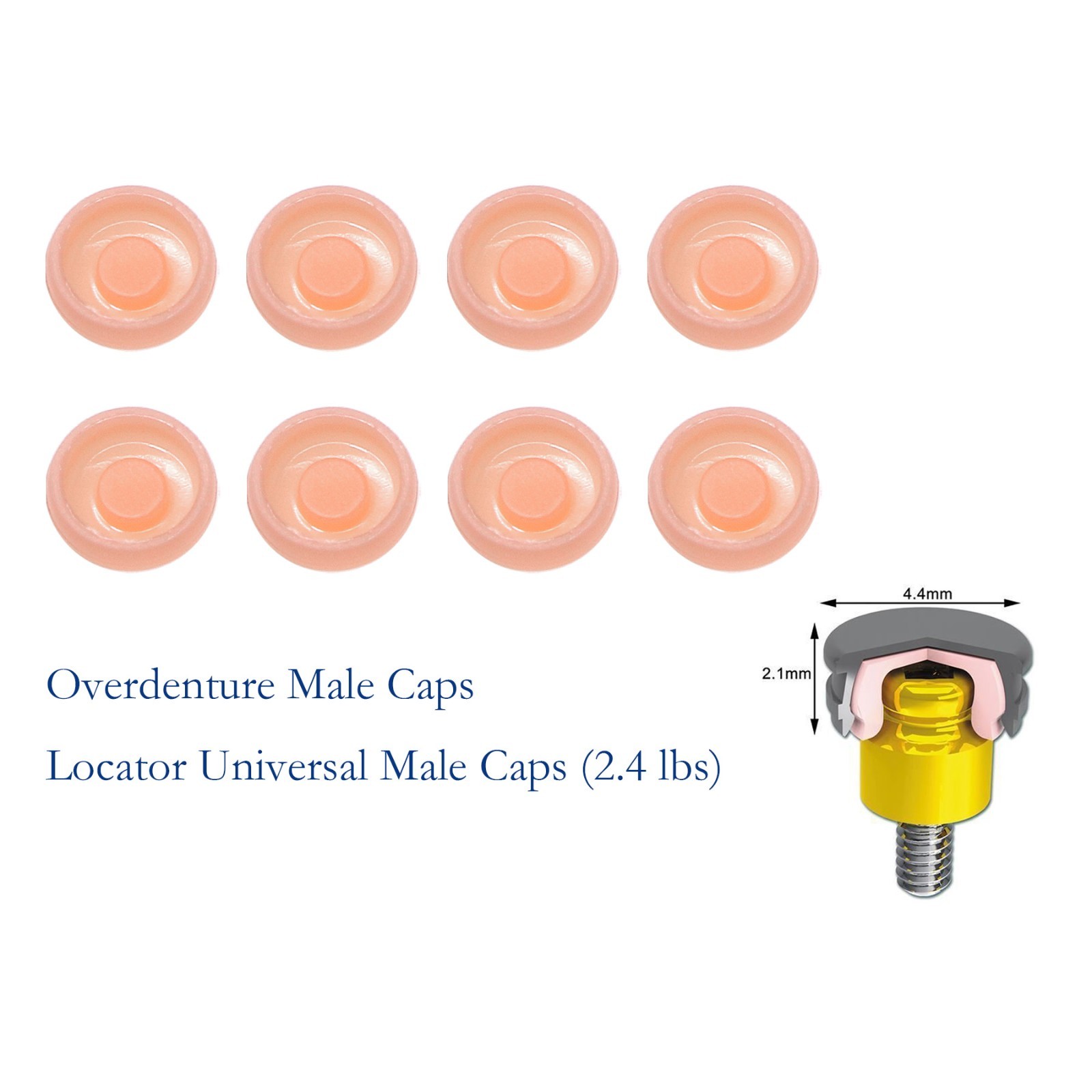 Dental Locator Classic Pink Standard Male Insert 2.4 lbs Light Retention Cap Set