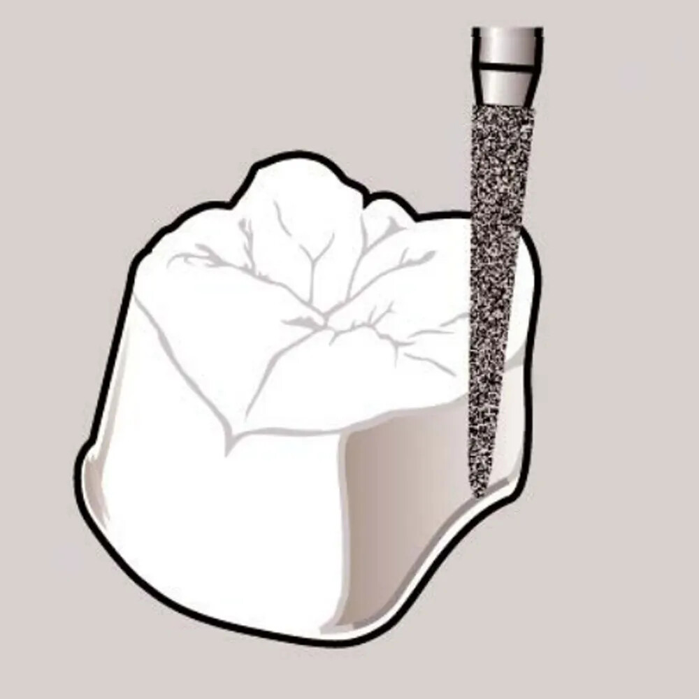 Frank Dental Tapered Cone Diamond Bur FG -TC (Made in India) diamond bur