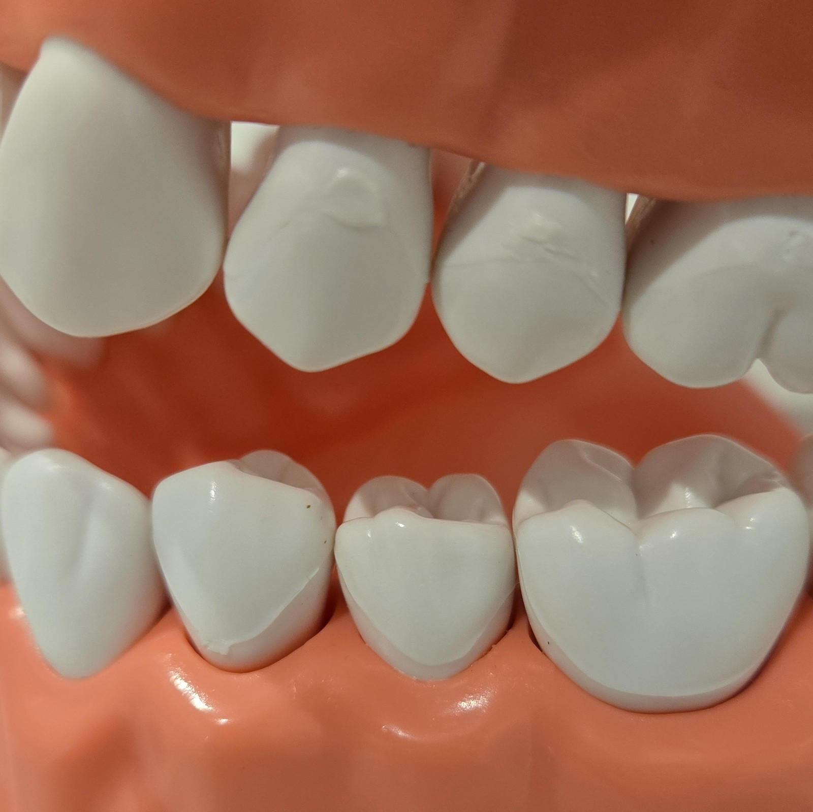 Hinged Dental Typodont Teeth Model with Toothbrush 1.5 Times Large