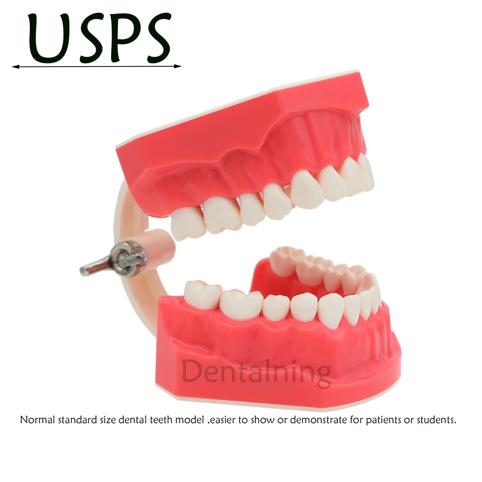 US Overdenture All-On-4/6 Implant /Ortho/Columbia 860/Kilgore NISSIN Teeth Model