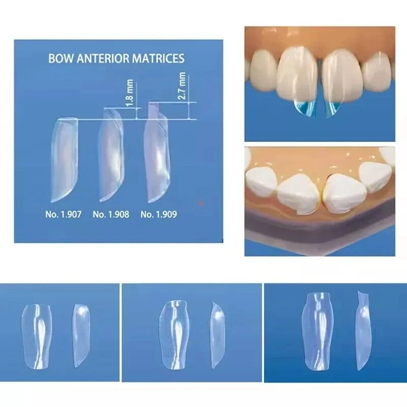 Dental Proximal Anterior Strips Polyester Matrix Bands Clear Matrices Anterior