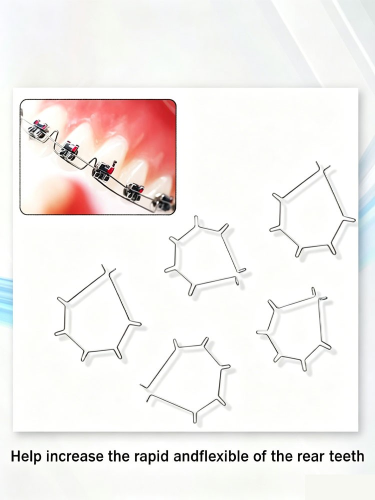 Dental Orthodontic Anterior Root Torquing Auxiliary Arch 5Pcs/Pack All Size