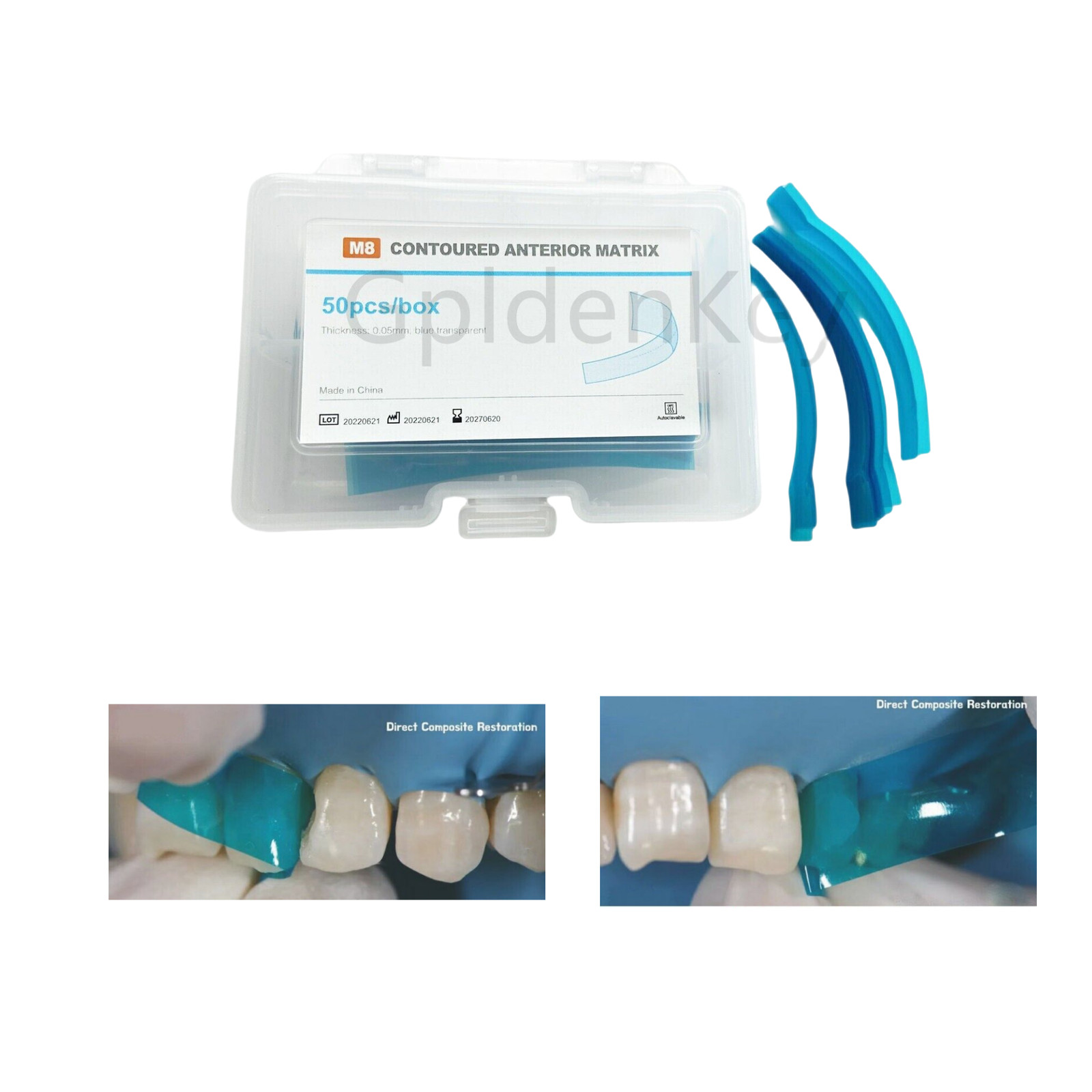 Dental Blue Strip Anterior Restoration Matrix Composite Resin Matrices 50Pcs/box