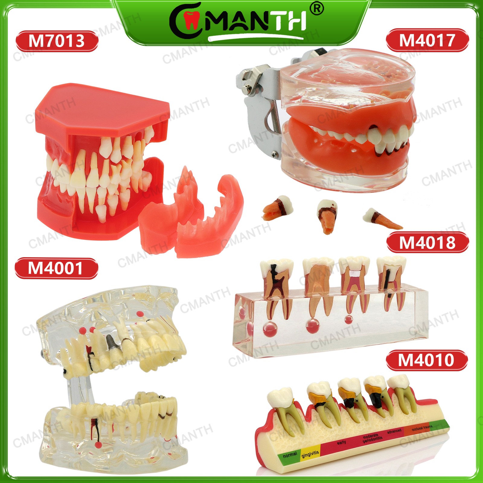 Multiple Types Dental Teeth Model Ortho Implant Practice Teaching Demo Model
