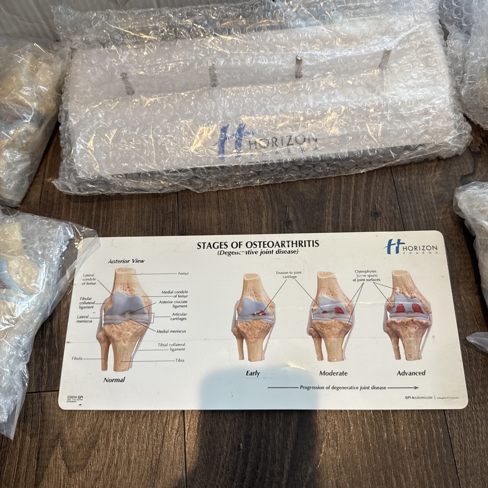 Knee Joint Osteoarthritis GPI Model Set horizon pharma