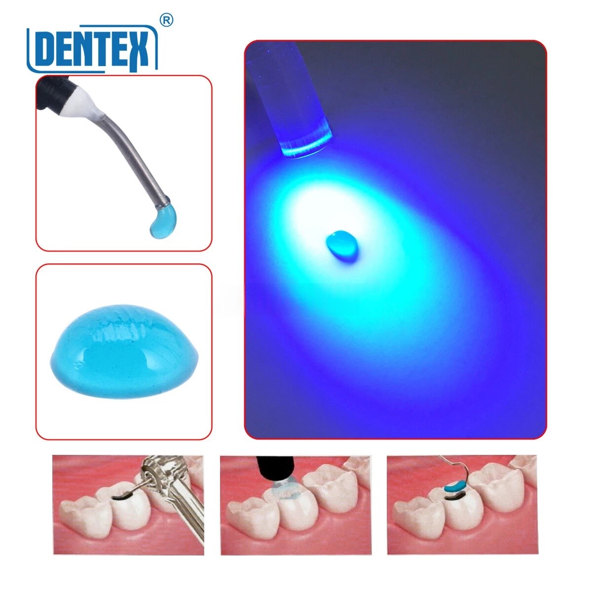 Dental Temporary Flow Light Cure Filling Composite Resin 2.5g DENTEX Blue