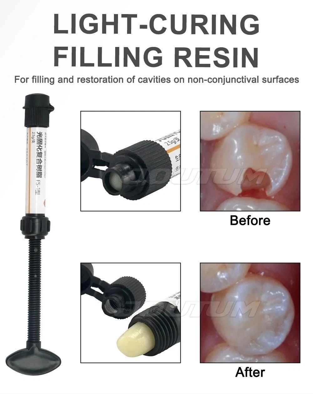 Dental Cement Resin Filling Materials Dentistry Denfil Syringe Universal Teeth