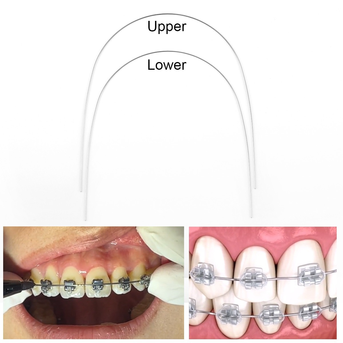 AZDENT Dental Ortho Super Elastic Niti Round Arch Wires Reverse Curve 10 Sizes