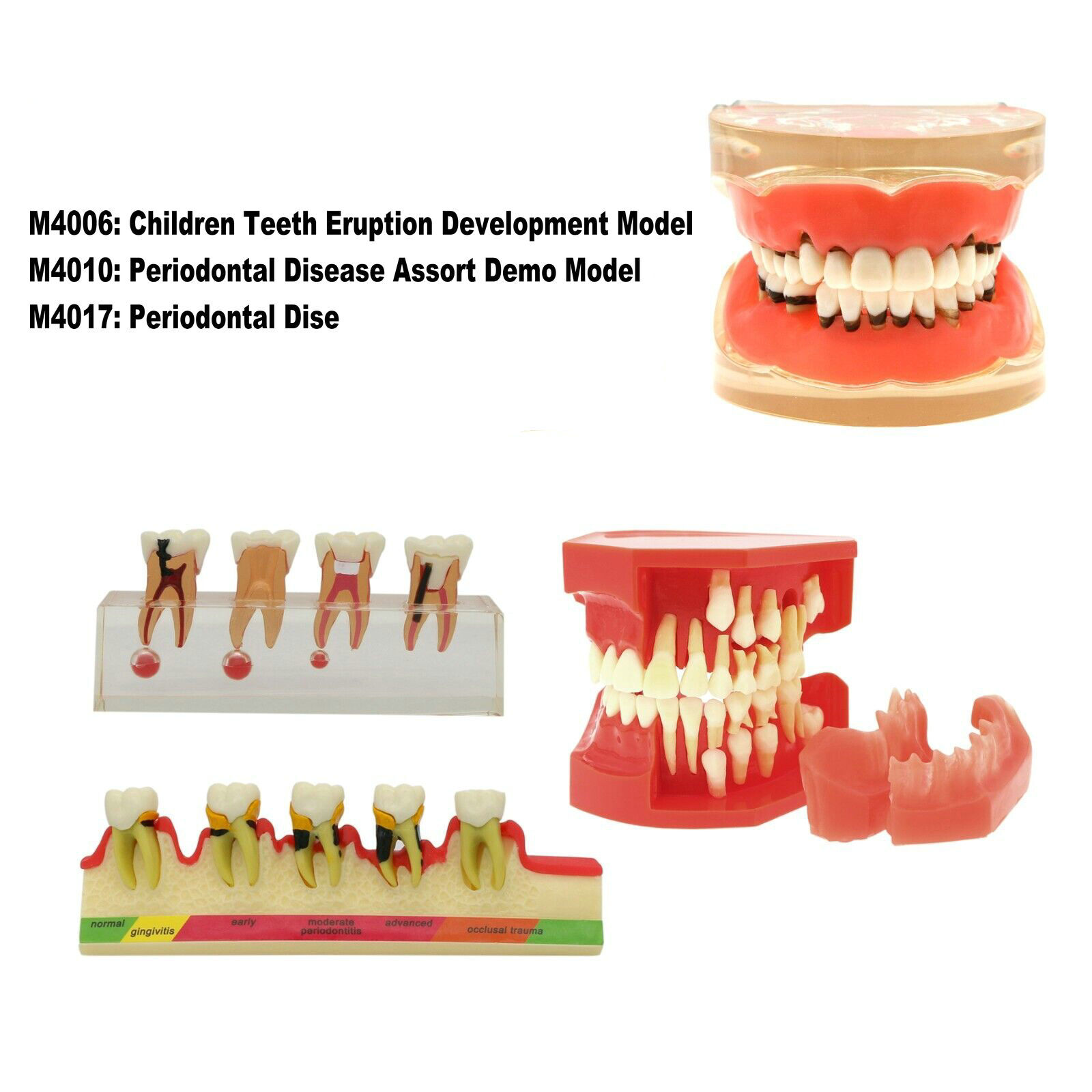 Multiple Types Dental Teeth Model Typodont Ortho Implant Practice Demo Teaching